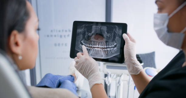 Licensed Wisdom Tooth Removal service in Jackson, CA - Smile Center Dentistry
